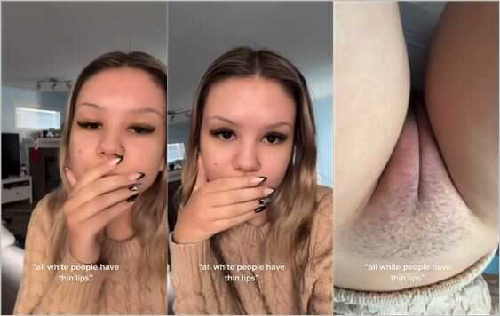 All white people have thin lips